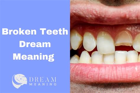  Common Interpretations of Dreaming About a Shattered Tooth 