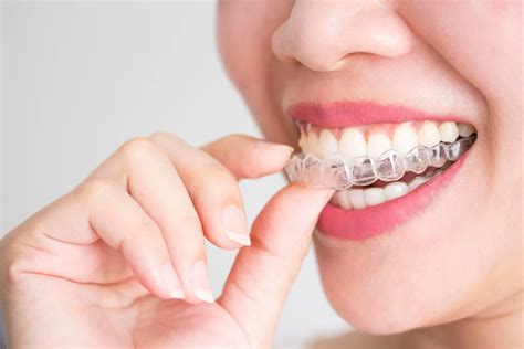  Dealing with the Challenges and Benefits of Orthodontic Treatment
