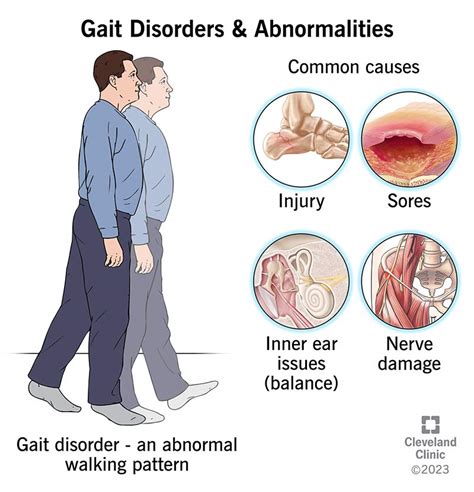  Examining Cultural and Historical Perspectives on Disturbed Gait in Dream Imagery 