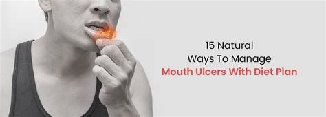  Exploring Effective Methods to Relieve Discomfort from Oral Ulcers 