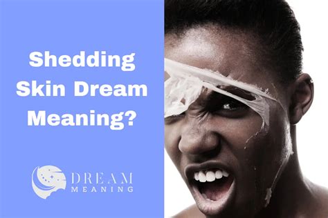  Interpretations of Dreams About Shedding Skin 