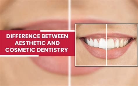  Selecting the Ideal Dentist to Transform Your Dental Aesthetics 