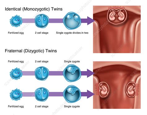  The Early View: Embracing the First Peek of Twin Development 