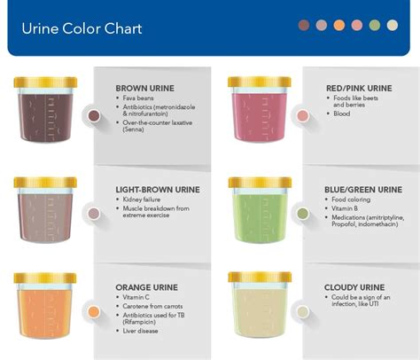  What to Expect During Diagnostic Testing for Discolored Urine 