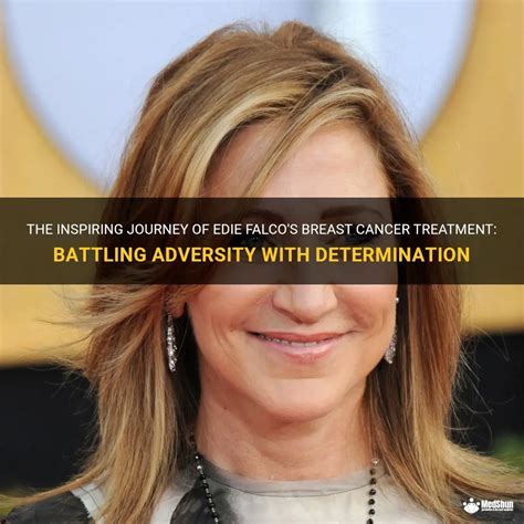 A Journey to Success: Edie Falco's Inspiring Path