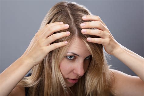 Alternative Approaches: Exploring Natural Remedies for Flaky Scalp