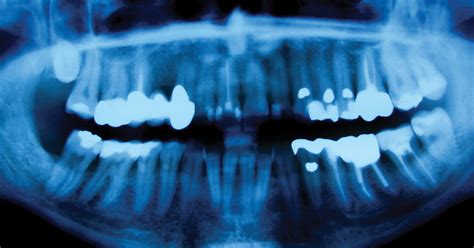 An Inside Look at Swelling in the Oral Cavity: Insights into Origins, Interpretations, and Remedies