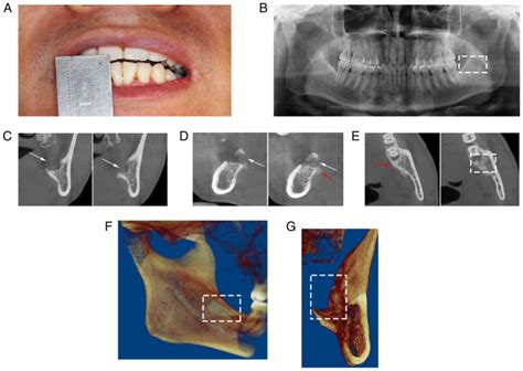 Analyzing the Cultural and Historical Perspectives of Third Molar Extraction in Dream Imagery