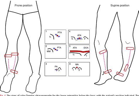 Analyzing the Possible Interpretations of Needle Perceptions in Lower Limb