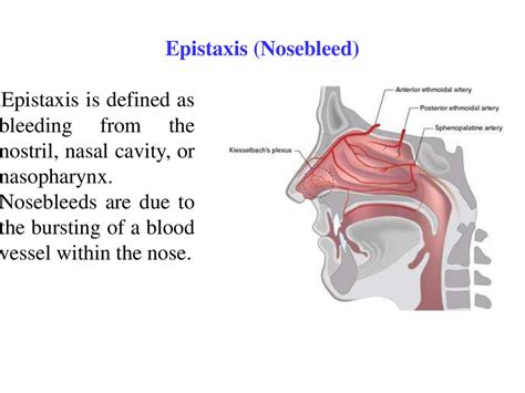 Analyzing the Potential Physical and Health-related Meanings of Epistaxis Dreams