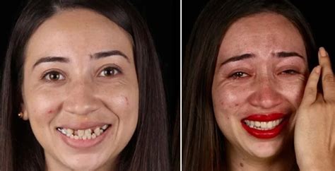 Before and After: Inspiring Stories of Dental Transformations