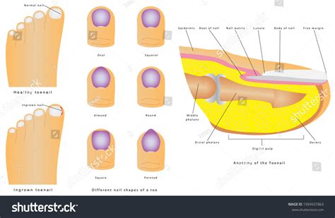 Beyond the Basics: The Art of Toenail Shaping