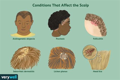 Beyond the Surface: Applying the Insights of Itchy Scalp Explorations to Real Life