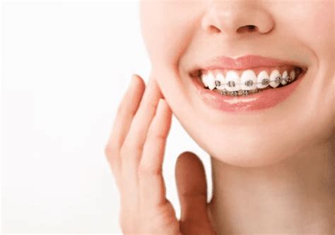 Boosting Confidence: The Psychological Benefits of Orthodontic Treatment