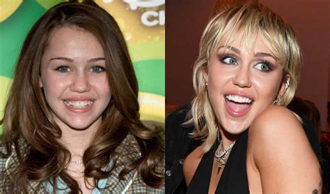 Breaking Stereotypes: Braces for Adults and Celebrities