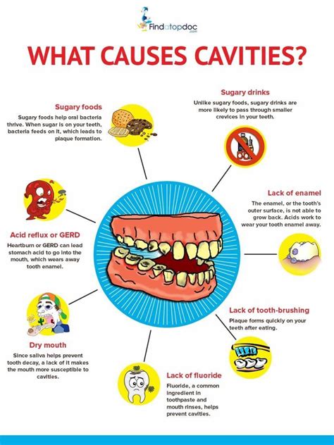 Causes and Prevention of Decayed Teeth