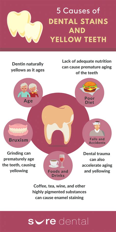 Common Causes of Yellow Teeth