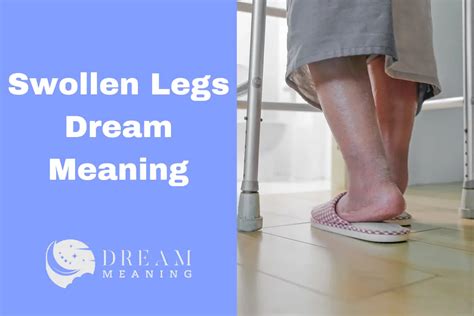 Common Dream Scenarios Involving Swollen Knees and Their Possible Meanings