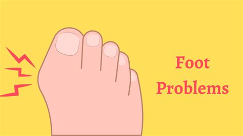 Common Foot Problems and How to Prevent Them