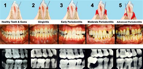 Common Interpretations of Dental and Gingival Dreams