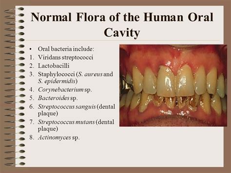 Common Misunderstandings Regarding Dreams About Flora in the Oral Cavity