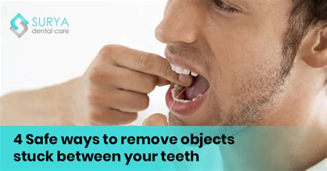 Common Objects Discovered in Dreams About Removing Objects From Teeth and Their Symbolic Significance