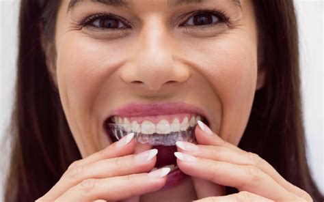 Common Pitfalls to Avoid when Wearing a Dental Retainer