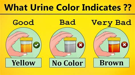 Common Reasons Behind the Appearance of Orange Urine