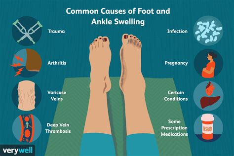 Common Reasons for Dreaming about Unappealing Feet