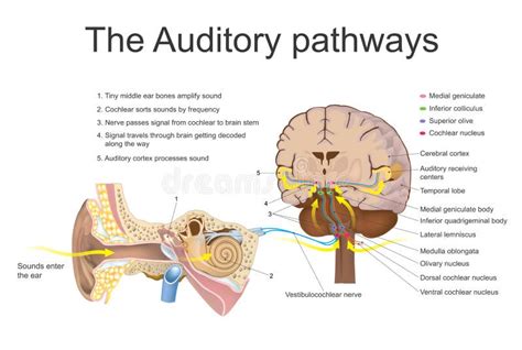 Common scenarios in dreams involving a absent auditory organ