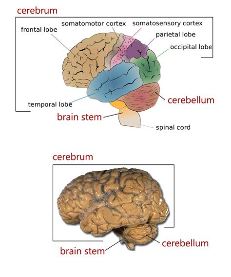 Connecting the Pieces: Identifying and Diagnosing Intriguing Cerebral Growths