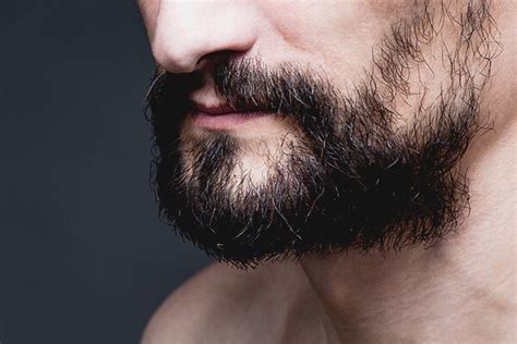 Conquering Obstacles: Overcoming Challenges with Patchy or Sparse Beard Growth