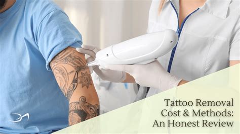 Considering Alternative Methods for Tattoo Removal: Worth Exploring?