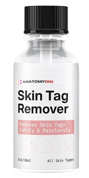 Considering Professional Help for Skin Tag Removal