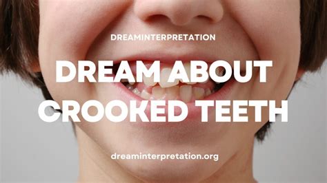 Cultural and Historical Significance of Dreams About Misaligned Teeth