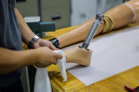 Customizing Prosthetic Feet: Tailoring Solutions for Individual Needs