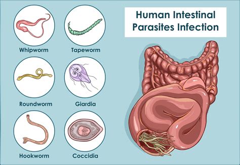 Deciphering the Significance of Extracting a Parasite from the Abdominal Region in Dreamscapes