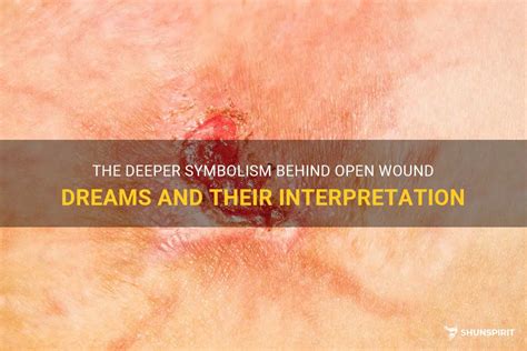 Decoding the Symbolic Significance of Stitched Wounds Marked upon the Forehead in Dreamscapes