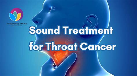 Discovering therapeutic alternatives for throat carcinoma