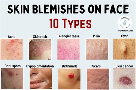 Dream Symbols: Deciphering the Significance of Skin Blemishes