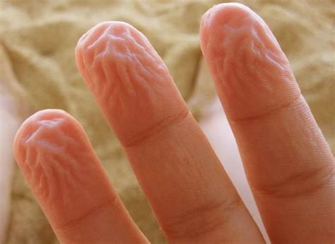 Dreaming About Losing a Finger: What Does It Indicate About Your Life?