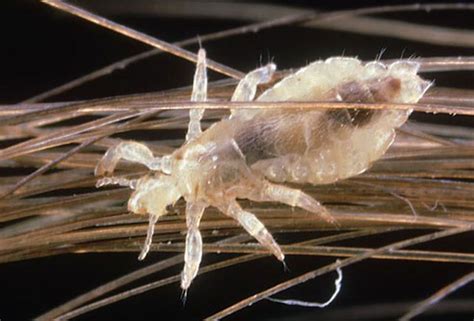 Dreaming of another person experiencing head lice: Decoding its symbolic significance