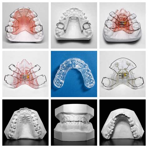 Dreams of Observing Someone Sporting Orthodontic Appliances: What is the Significance?