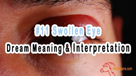 Dreams of a Swollen Eye: Symbolic Interpretations