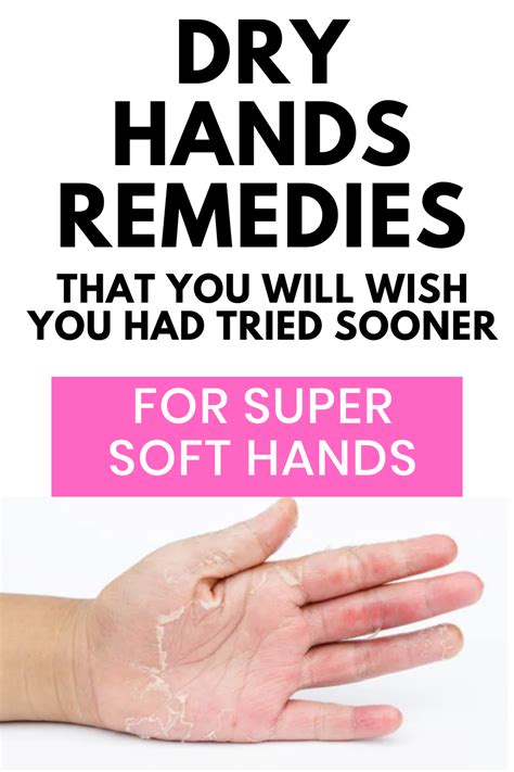 Effective Home Remedies for Velvety and Supple Hands