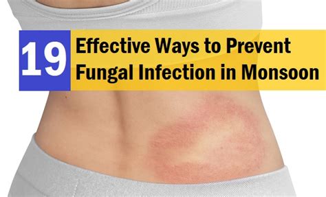 Effective Strategies for Preventing Fungal Infestation