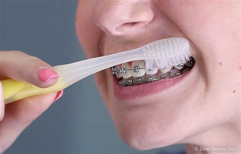 Effective Techniques for Brushing and Flossing