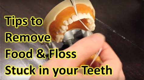 Effective Techniques for Removing Food and Objects Using Dental Floss