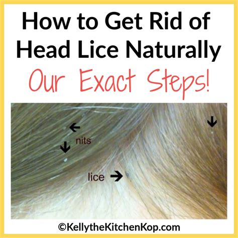 Effective Ways to Eliminate Head Lice at Home