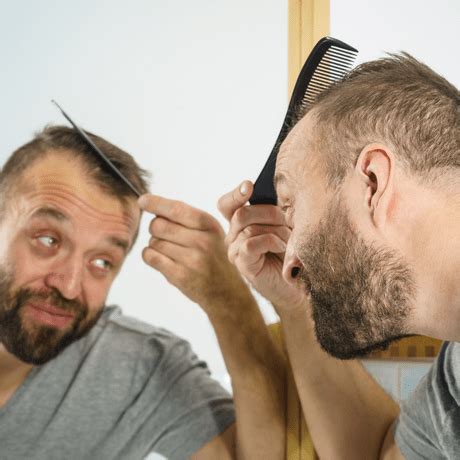 Embracing Baldness: Tips for Embracing and Loving Your Hairless Appearance